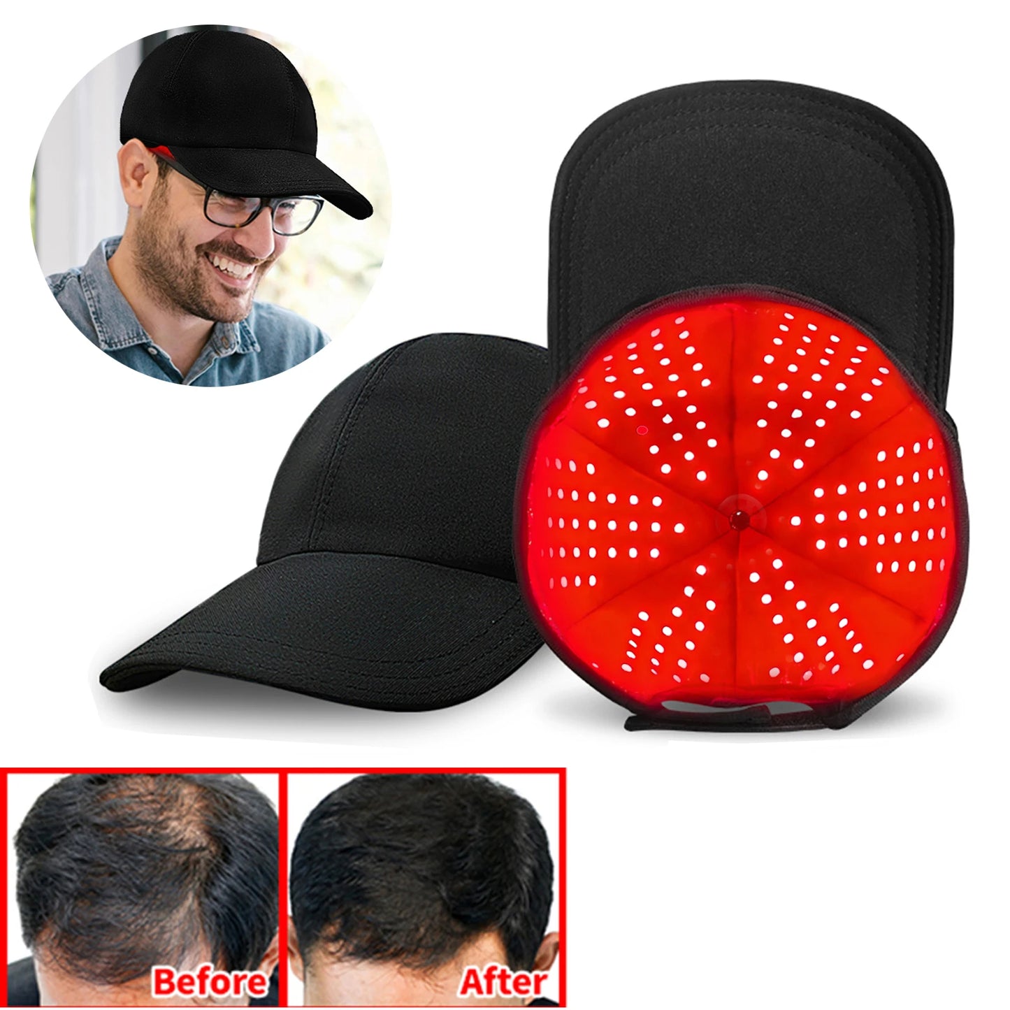 HairRevive™ Therapy Cap by Ainiki